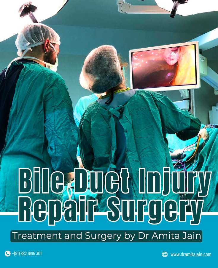 Gallbladder Bile Duct Injury Repair Surgery by Dr Amita Jain
